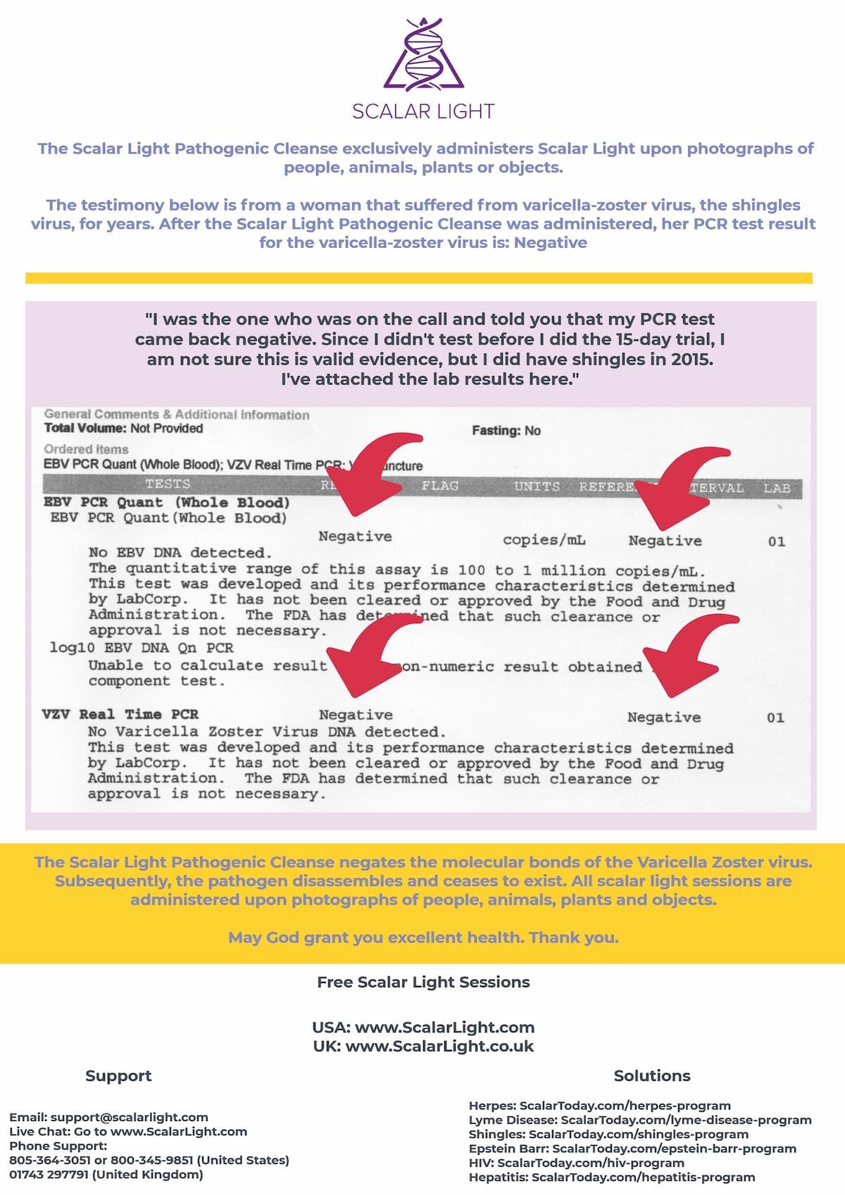 Shingles Virus PCR Test